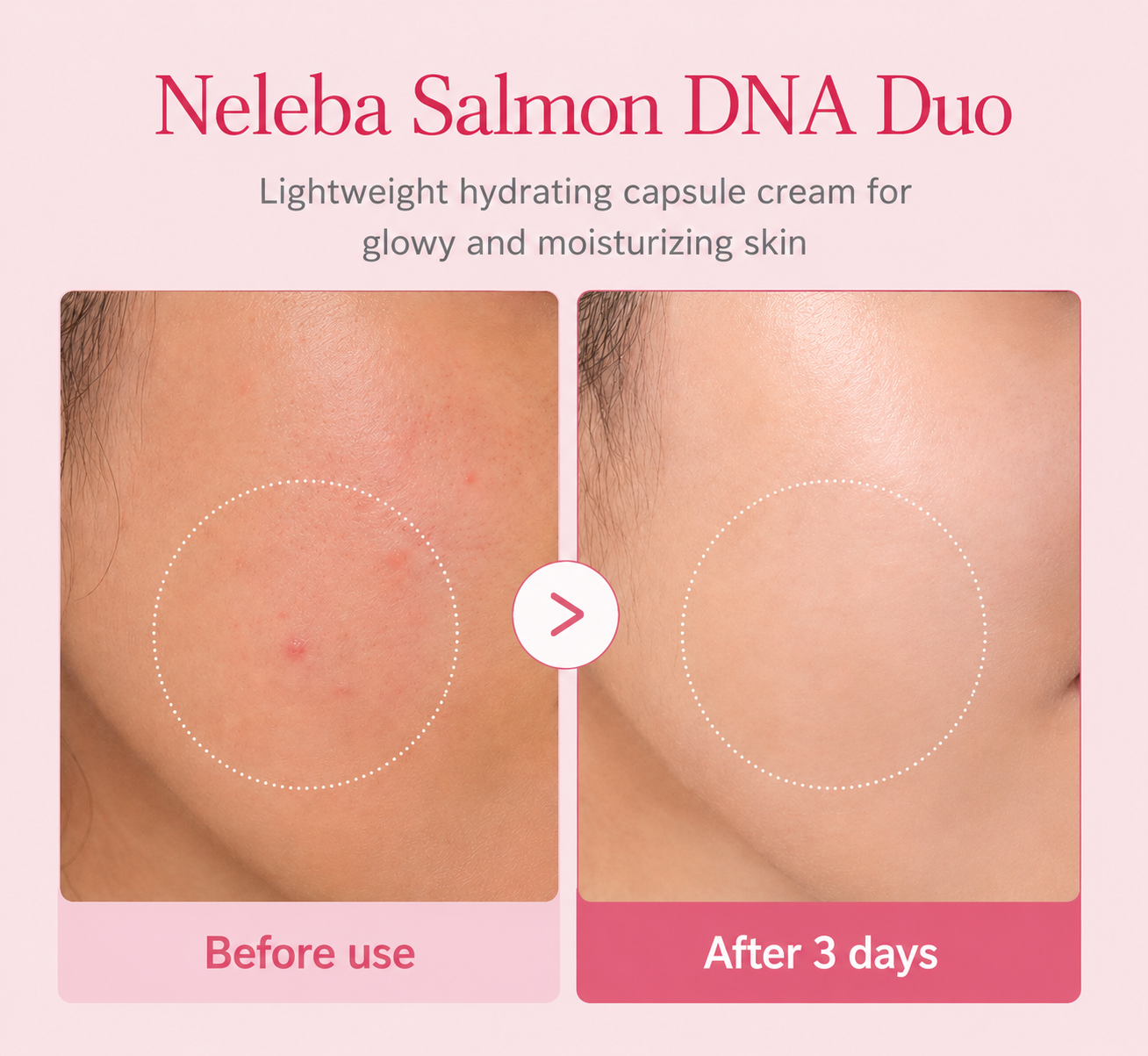 Neleba Salmon DNA Duo