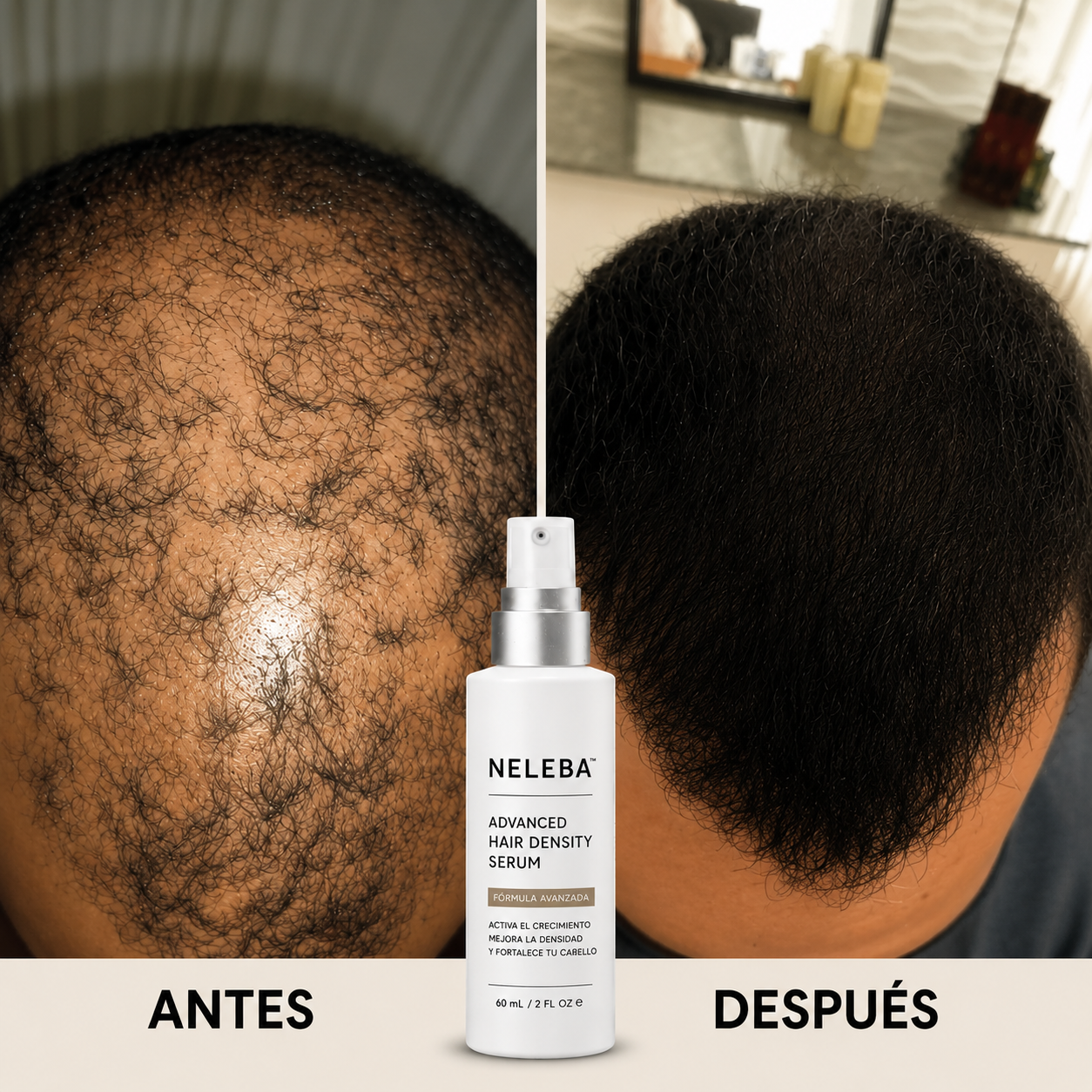 Neleba™ Follic Renew