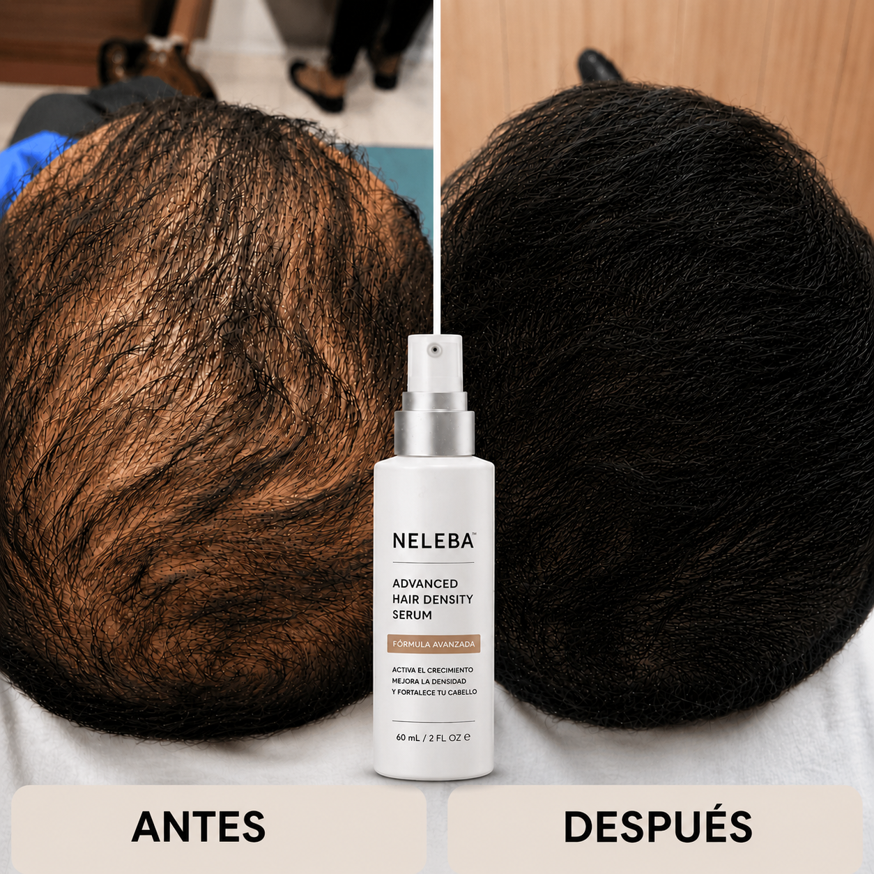 Neleba™ Follic Renew