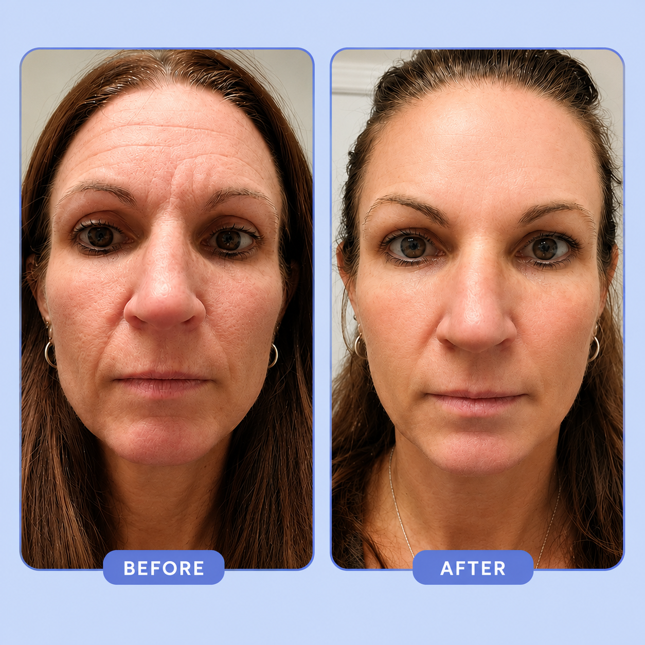 Neleba Sleep Wrinkle Patches