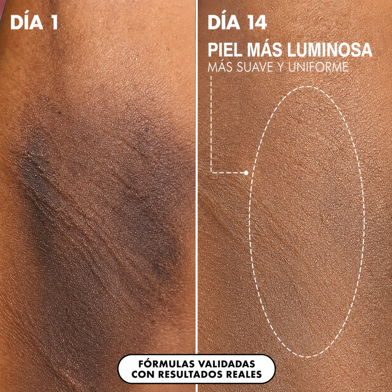 Neleba™ Lúmea